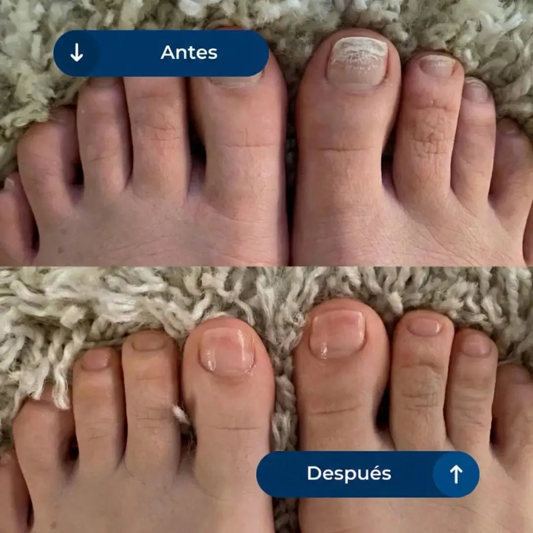 Aceite Ozonizado - Protocolo Oxi-Break™ 21 días