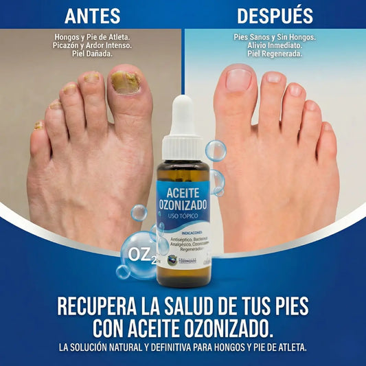 Aceite Ozonizado - Protocolo Oxi-Break™ 21 días